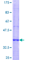 ab163528 on a 12.5% SDS-PAGE stained with Coomassie Blue.