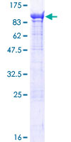 ab161903 on a 12.5% SDS-PAGE stained with Coomassie Blue.