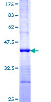 ab163156 on a 12.5% SDS-PAGE stained with Coomassie Blue.