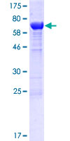 ab163632 on a 12.5% SDS-PAGE stained with Coomassie Blue.