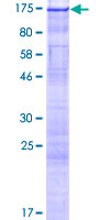 ab163636 on a 12.5% SDS-PAGE stained with Coomassie Blue.
