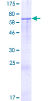 ab164282 on a 12.5% SDS-PAGE stained with Coomassie Blue.