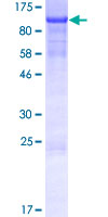 ab165700 on a 12.5% SDS-PAGE stained with Coomassie Blue.