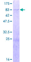 ab164999 on a 12.5% SDS-PAGE stained with Coomassie Blue.