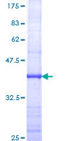 ab163147 on a 12.5% SDS-PAGE stained with Coomassie Blue.