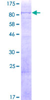 ab165218 on a 12.5% SDS-PAGE stained with Coomassie Blue.