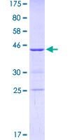 ab161139 on a 12.5% SDS-PAGE stained with Coomassie Blue.