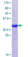 ab161514 on a 12.5% SDS-PAGE stained with Coomassie Blue.