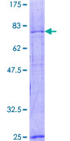 ab158792 on a 12.5% SDS-PAGE stained with Coomassie Blue.