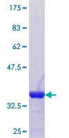 ab152977 on a 12.5% SDS-PAGE stained with Coomassie Blue.