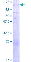 ab158793 on a 12.5% SDS-PAGE stained with Coomassie Blue.