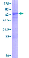 ab165970 on a 12.5% SDS-PAGE stained with Coomassie Blue.