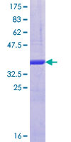 ab163790 on a 12.5% SDS-PAGE stained with Coomassie Blue.