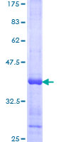 ab160631 on a 12.5% SDS-PAGE stained with Coomassie Blue.