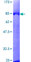 ab158800 on a 12.5% SDS-PAGE stained with Coomassie Blue.