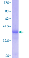 ab158801 on a 12.5% SDS-PAGE stained with Coomassie Blue.