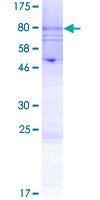 ab158785 on a 12.5% SDS-PAGE stained with Coomassie Blue.