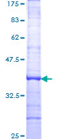 ab158794 on a 12.5% SDS-PAGE stained with Coomassie Blue.