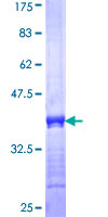 ab158788 on a 12.5% SDS-PAGE stained with Coomassie Blue.