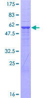 ab165290 on a 12.5% SDS-PAGE stained with Coomassie Blue.