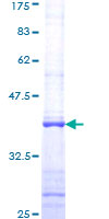 ab165291 on a 12.5% SDS-PAGE stained with Coomassie Blue.
