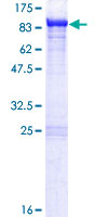 ab153495 on a 12.5% SDS-PAGE stained with Coomassie Blue.