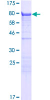 ab165560 on a 12.5% SDS-PAGE stained with Coomassie Blue.