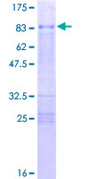 ab159699 on a 12.5% SDS-PAGE stained with Coomassie Blue.
