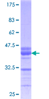 ab159700 on a 12.5% SDS-PAGE stained with Coomassie Blue.