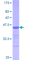 ab159701 on a 12.5% SDS-PAGE stained with Coomassie Blue.