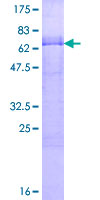 ab161396 on a 12.5% SDS-PAGE stained with Coomassie Blue.