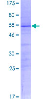ab164447 on a 12.5% SDS-PAGE stained with Coomassie Blue.