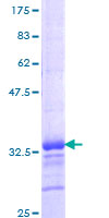 ab160963 on a 12.5% SDS-PAGE stained with Coomassie Blue.