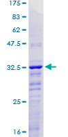 ab160964 on a 12.5% SDS-PAGE stained with Coomassie Blue.