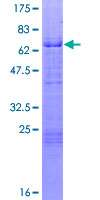 ab162484 on a 12.5% SDS-PAGE stained with Coomassie Blue.