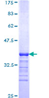 ab162485 on a 12.5% SDS-PAGE stained with Coomassie Blue.