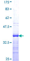 ab157976 on a 12.5% SDS-PAGE stained with Coomassie Blue.