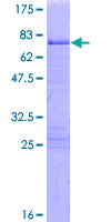 ab161398 on a 12.5% SDS-PAGE stained with Coomassie Blue.