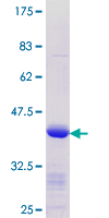 ab161399 on a 12.5% SDS-PAGE stained with Coomassie Blue.