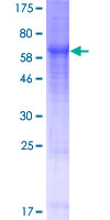 ab165192 on a 12.5% SDS-PAGE stained with Coomassie Blue.