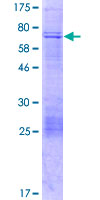 ab161499 on a 12.5% SDS-PAGE stained with Coomassie Blue.
