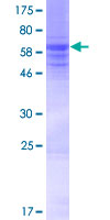 ab163021 on a 12.5% SDS-PAGE stained with Coomassie Blue.