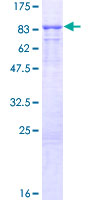 ab164815 on a 12.5% SDS-PAGE stained with Coomassie Blue.