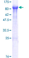 ab163589 on a 12.5% SDS-PAGE stained with Coomassie Blue.
