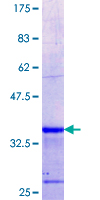 ab161392 on a 12.5% SDS-PAGE stained with Coomassie Blue.
