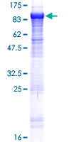 ab164675 on a 12.5% SDS-PAGE stained with Coomassie Blue.