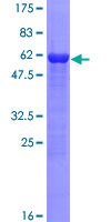 ab153271 on a 12.5% SDS-PAGE stained with Coomassie Blue.
