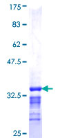 ab153272 on a 12.5% SDS-PAGE stained with Coomassie Blue.