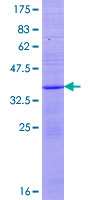 ab162516 on a 12.5% SDS-PAGE stained with Coomassie Blue.