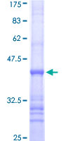 ab162517 on a 12.5% SDS-PAGE stained with Coomassie Blue.